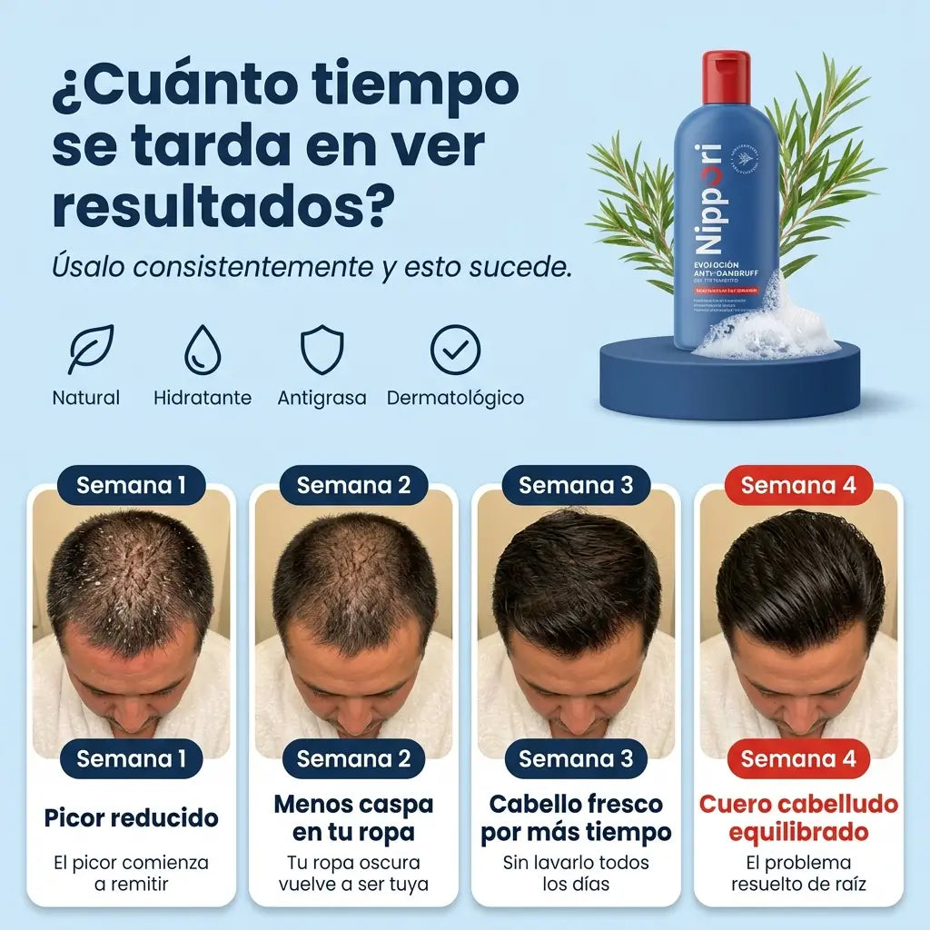 Nippori® | Shampoo Anticaspa Control Grasa