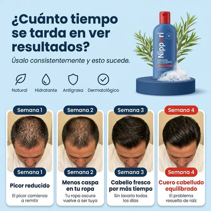 Nippori® | Shampoo Anticaspa Control Grasa